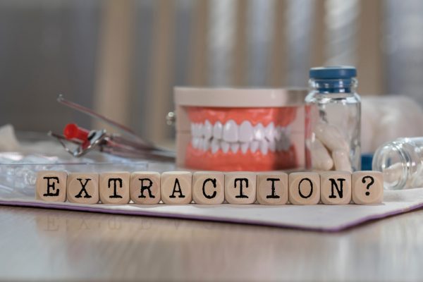 tooth extraction